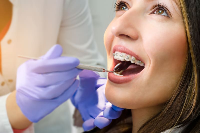 Questions communes à propos du traitement orthodontique