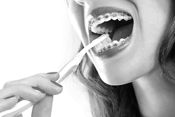 Conseils d’hygiène bucco-dentaire pour les personnes avec un appareil dentaire